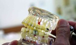 Erzincan’da sahte diş doktoru vatandaşları dolandırdı