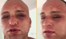 Rum mahkumlar Survivor Taner'i komalık ettiler!