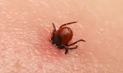 Kene Isırığı Ölümcül Olabilir: Uzmanlar KKKA'ya Karşı Uyardı