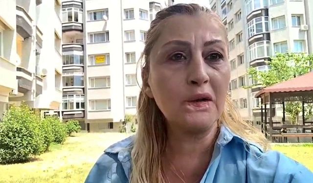 Estetik işlem sonrası dudağı çürüdü, 7 yıldır hukuk mücadelesi veriyor