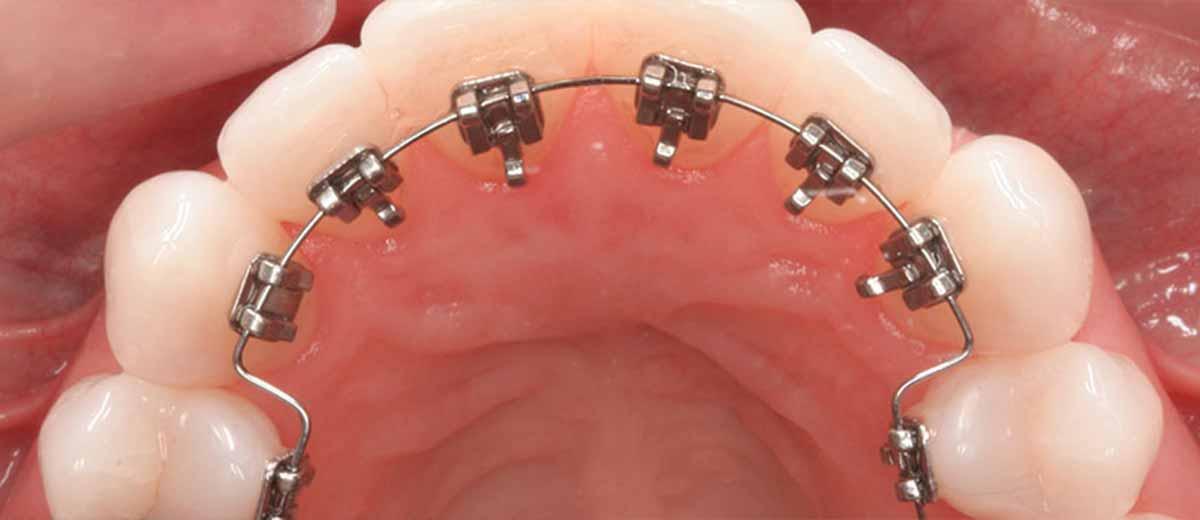 Ortodonti-tanitim-yazisi