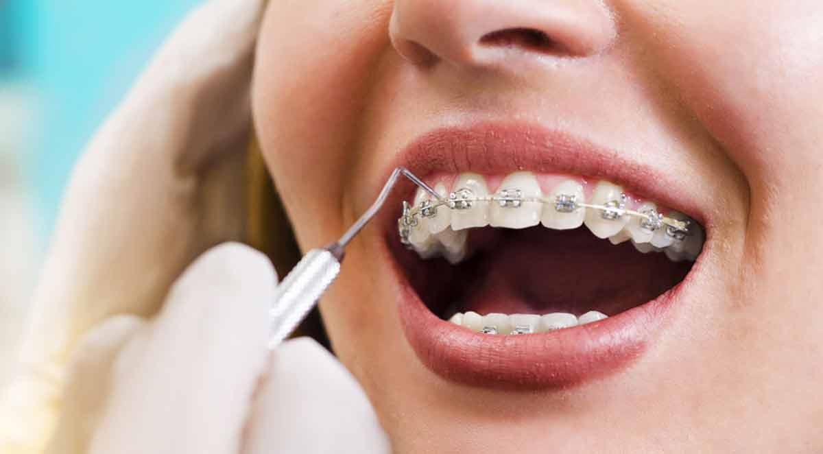 Ortodonti-tanitim-yazisi2