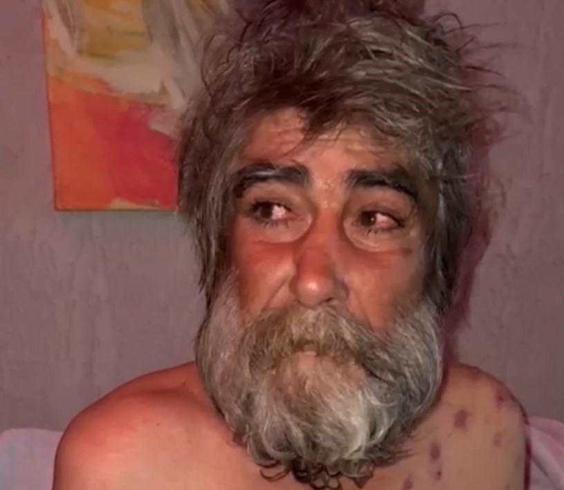 Sokakta Kalan Vatandaşın Inanılmaz Değişimi1